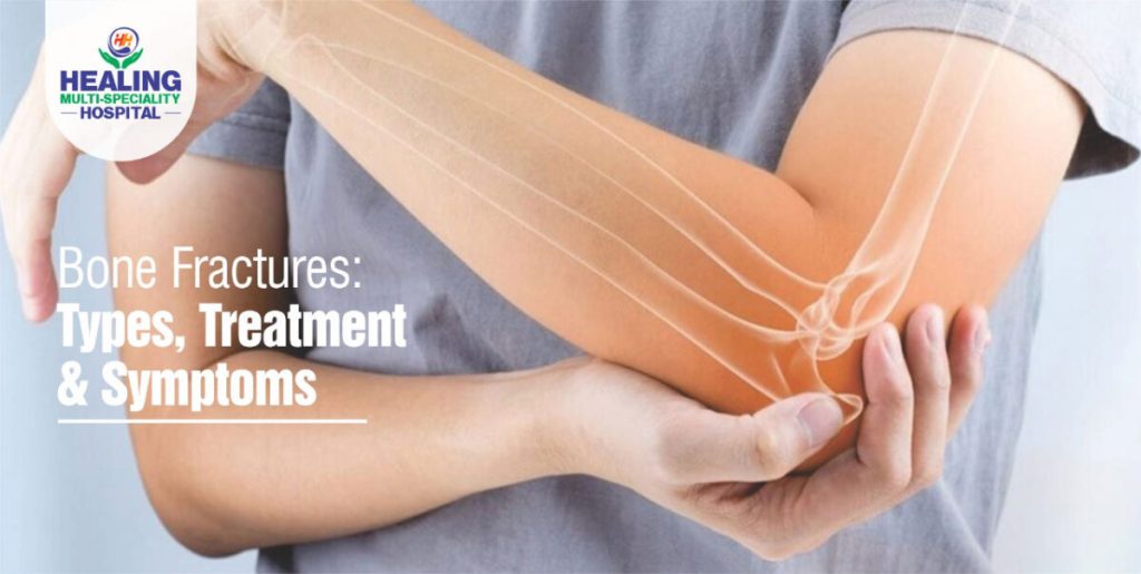 Bone Fractures Types, Symptoms and Treatment in Chandigarh