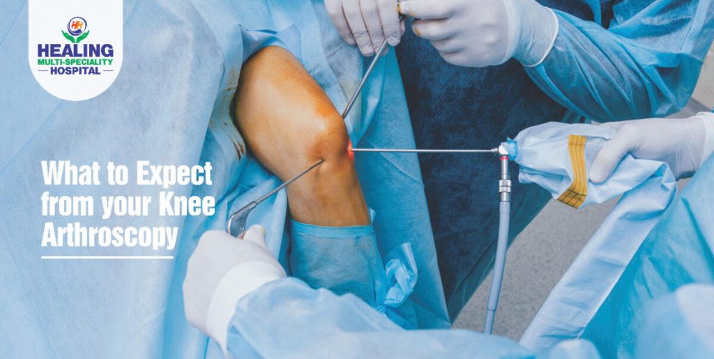 Knee arthroscopy