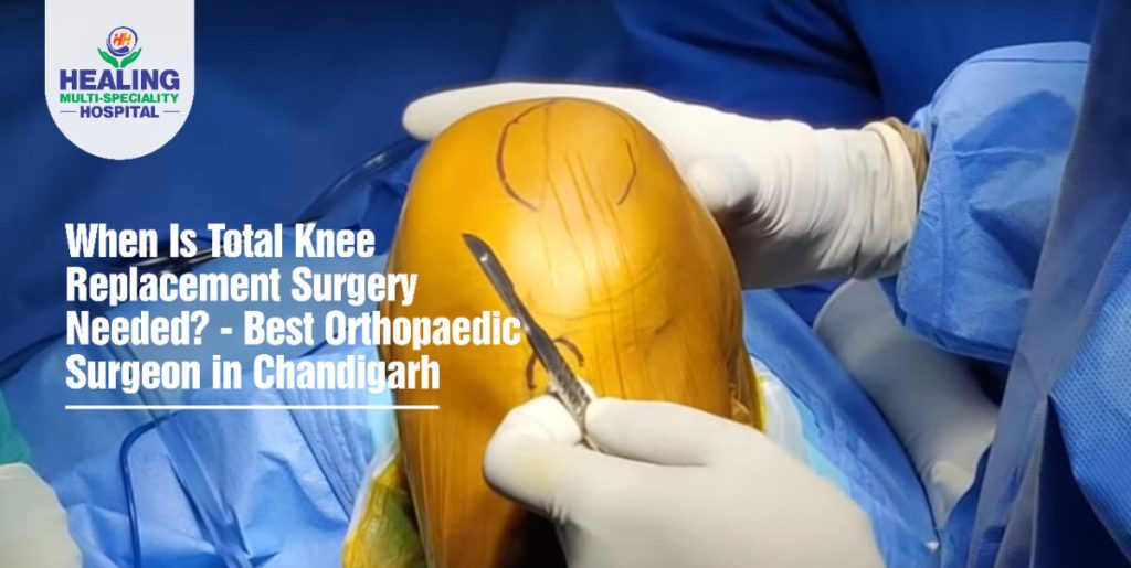 Best Orthopaedic Surgeon in Chandigarh