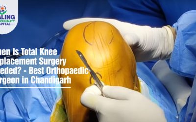 Best Orthopaedic Surgeon in Chandigarh