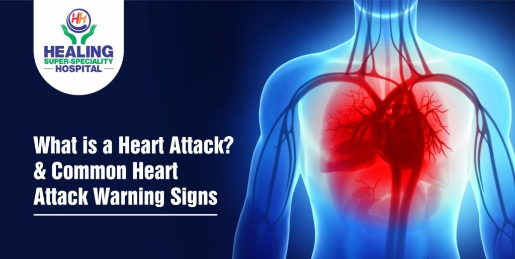 Heart Attack Treatment in Chandigarh Healing Hospital