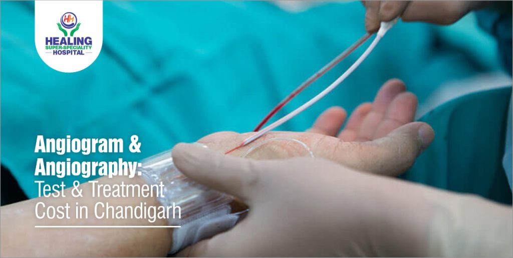 Angiography cost in Chandigarh