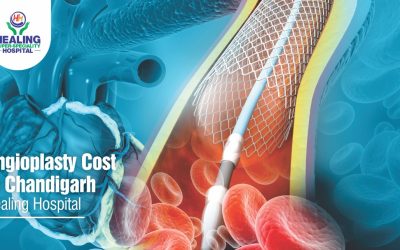 Angioplasty Cost in Healing hospital in Chandigarh