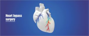 Best Heart Hospital in Mohali