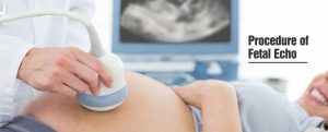 Fetal ECHO Test Price in Chandigarh