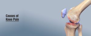 Knee Pain Treatment Specialist in Chandigarh Mohali