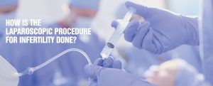 How is the Laparoscopic Procedure for infertility done