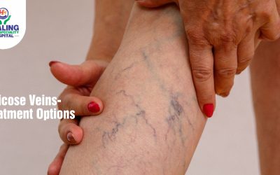 Varicose Veins-Treatment Options