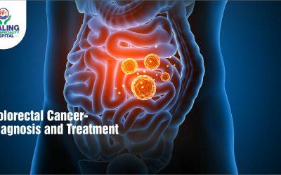 Colorectal Cancer