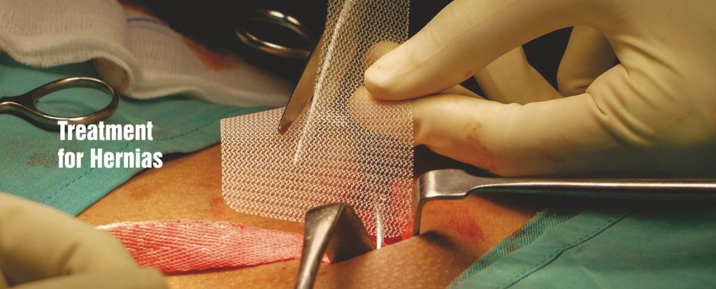 Hernia Treatment In Chandigarh