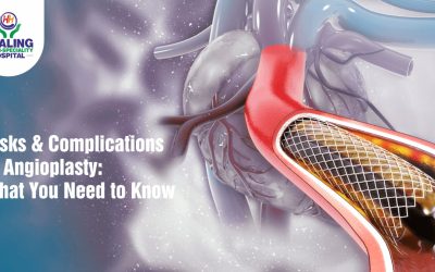 best Angioplasty hospital in Chandigarh