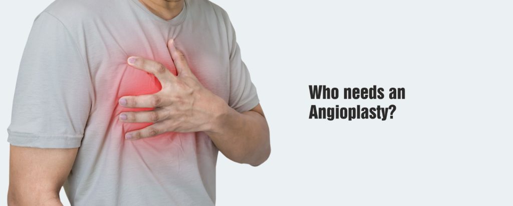 best Angioplasty hospital in Chandigarh