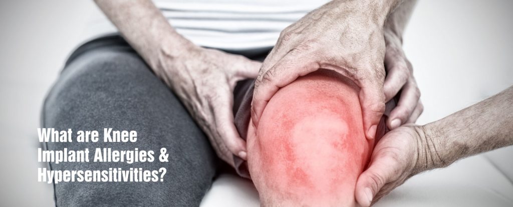 Best Knee Replacement Doctor in Chandigarh