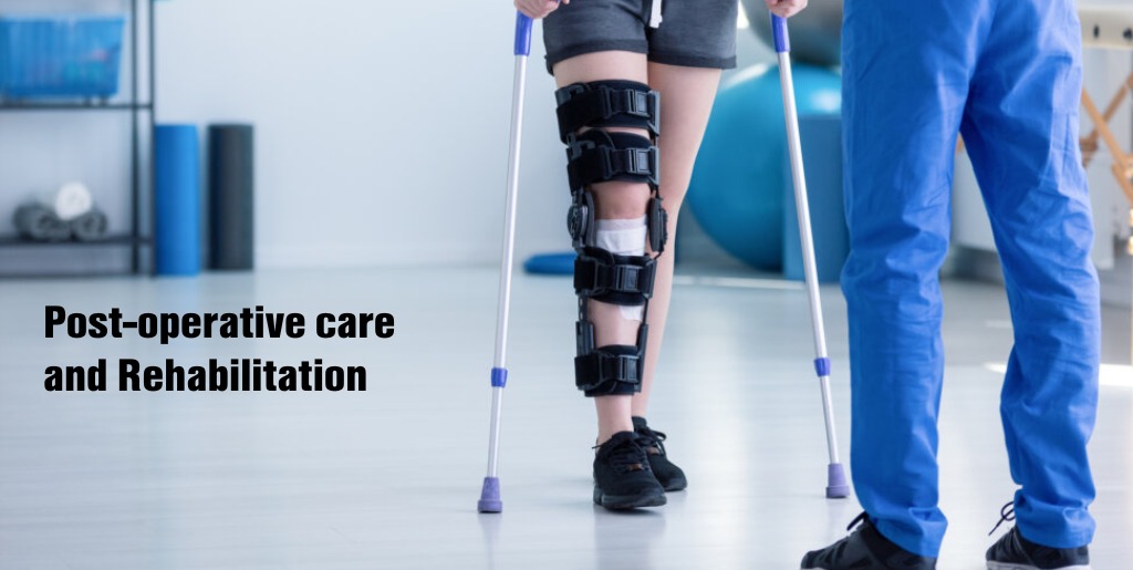 Knee replacement surgery in Delhi