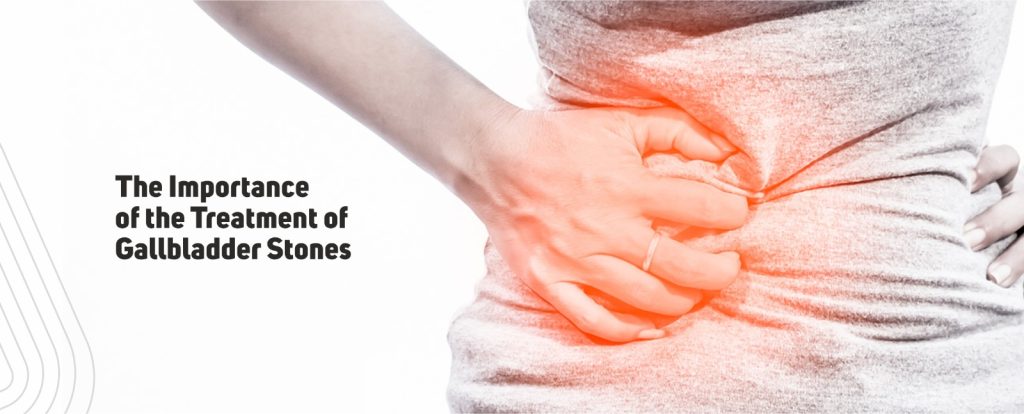 Gallbladder stone treatment in Chandigarh