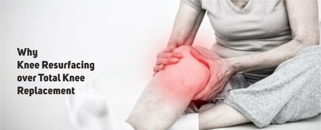 Remove term: Total Knee Replacement in Chandigarh Total Knee Replacement in Chandigarh