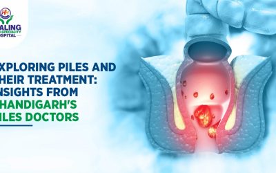 Piles doctor in Chandigarh
