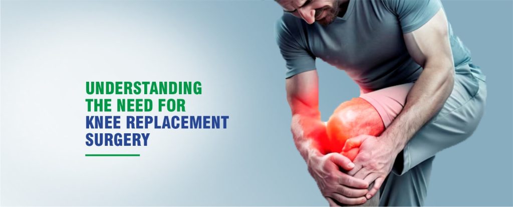 Best Knee Replacement Doctor in Chandigarh
