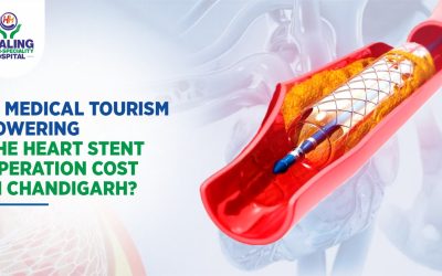 Best Stenting hospital in Chandigarh