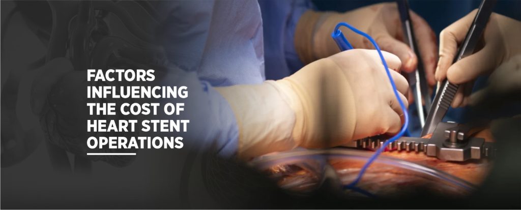 Best Stenting hospital in Chandigarh