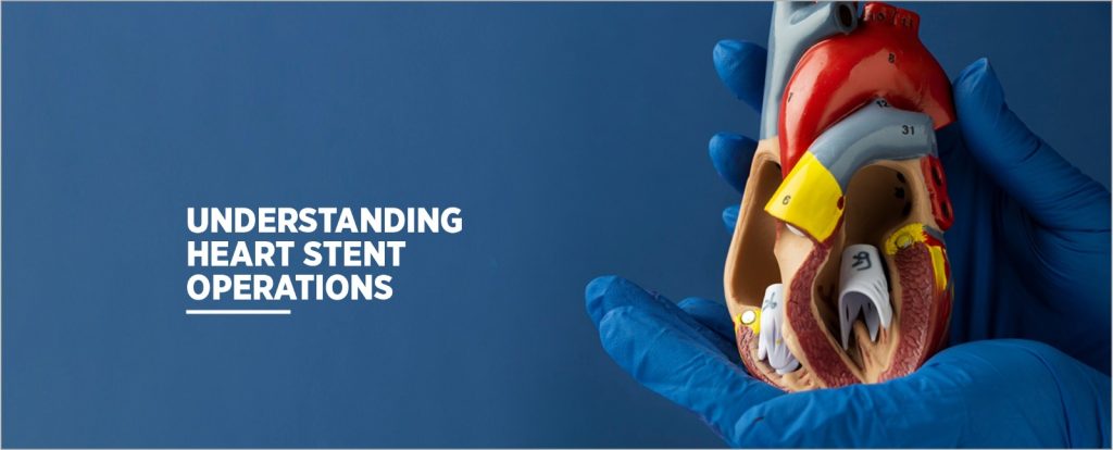 Best Stenting hospital in Chandigarh