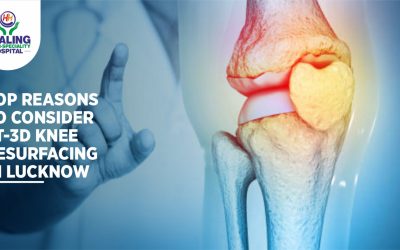 FT-3D Knee Resurfacing in Lucknow